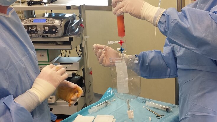 Kit monouso chirurgia rigenerativa cellule mesenchimali