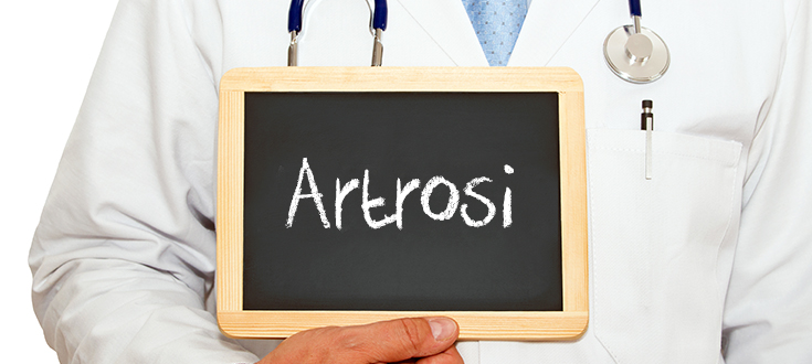 artrosi